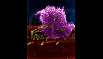 (图)巨噬细胞