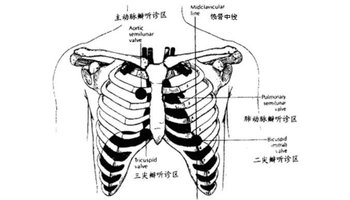 将耳紧贴胸壁或将听诊器放在胸壁一定部位,听到的声音