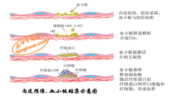 概述 在该类疾病中血小板数量正常,但不能正常地形成血栓并且出血时间