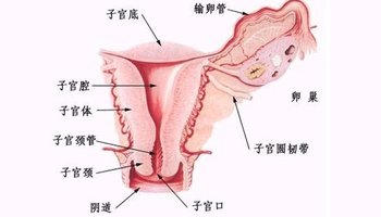 而典型的异位妊娠是胚胎没有到达子宫体,就在输卵管壁上开始成长.