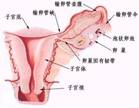 基本概述   子宫囊肿(uterine fibroid),是女性生殖器最常见的一种