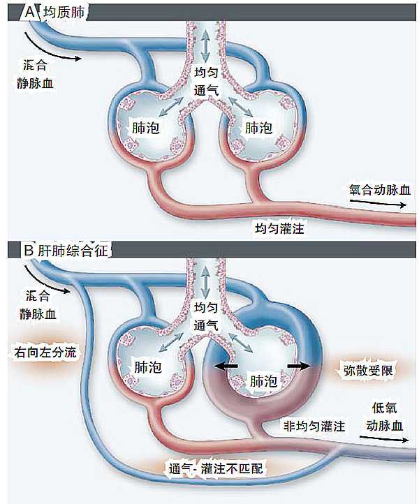 奇脉(paradoxical pulse)吸气时脉搏明显减弱甚至消失的现象称为奇脉