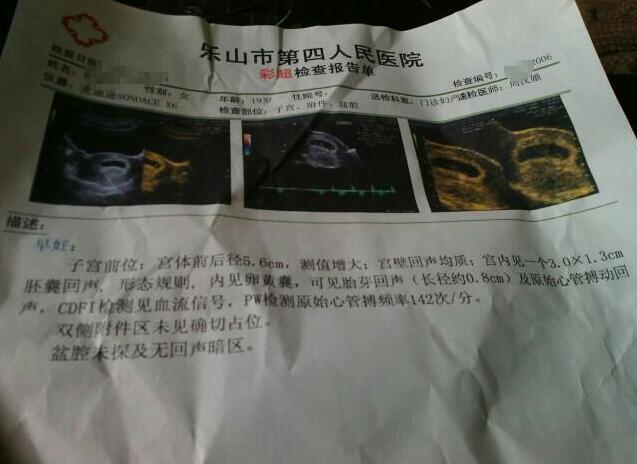 说说我怀我闺女的症状,不喜勿喷