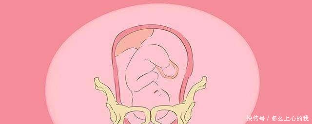 临近预产期,这四个情况可能影响会胎儿的入盆