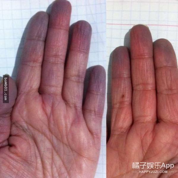 当你终于找到暖手的东西时,你的手指就开始由惊人的紫色慢慢变为正常