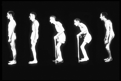 正常人到颈椎变形的图片_360问答