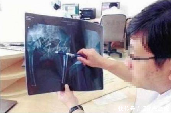 女孩肚子痛身体不舒服，父亲带她去医院检查，医生选择了报警