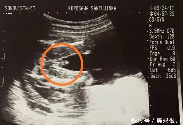 怀孕8个月孕妇胎儿变化大:男宝宝长这个样子,