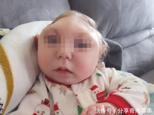 女孩只有半颗头,活到6岁去世,父母收拾她房间时,掀开床单懵了