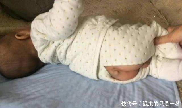 新生儿屁股后长个包,被诊断为脊柱裂,宝妈孕期