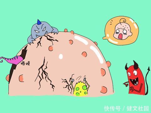 专治湿疹:湿疹反复,一味秘方,告别湿疹