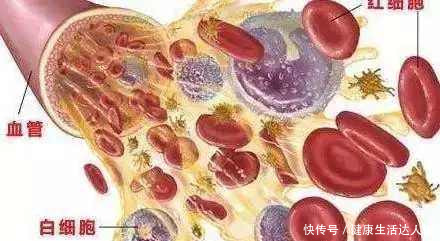 身上莫名有淤青如果身体还伴随有这些症状,可