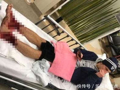 男子下海泡脚解乏,上岸后发现双脚上全是洞,原因让人惊讶不已