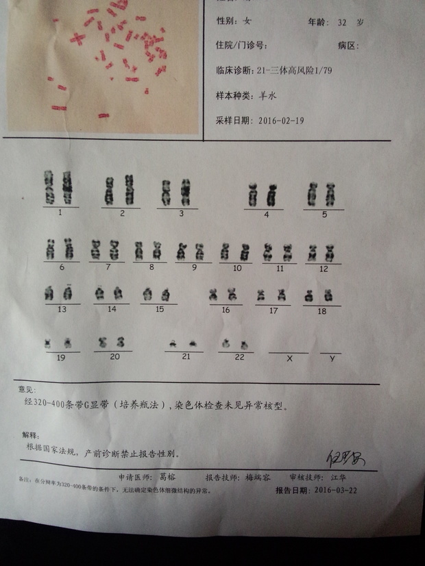 人染色体核型分析客观结果如何看