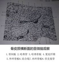 组织学上骨组织可分为板层骨和非板层骨.