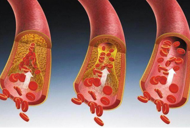 快速降血压最好的偏方_360问答