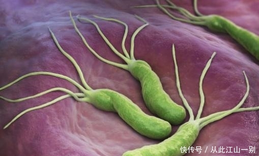 体检查出幽门螺杆菌怎么办? 假阴性存在吗?