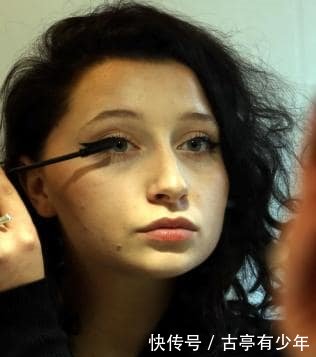 19岁的美女染染发剂几乎致命的过敏反应,导致