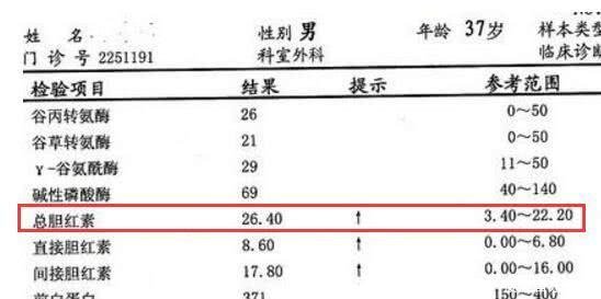 胆红素高是肝病 先看你有没有这些症状, 用这个