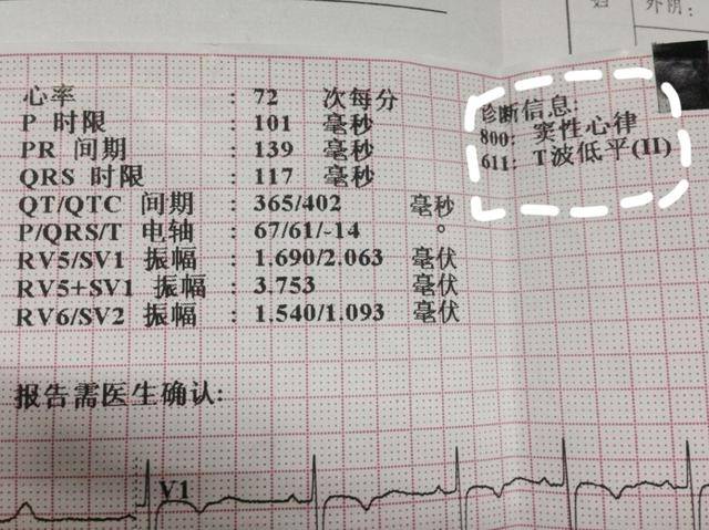 什么叫\＂窦性心律\＂?\＂窦性心律不齐\＂是病吗?需要治疗吗?