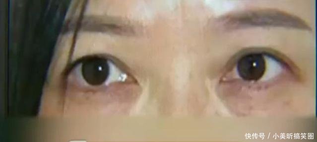 女子坚决要求美容院退费赔偿老公说越来越难看