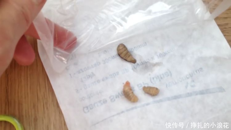 女子发现自己手臂有动静，体内拔出的东西令医生直咽口水