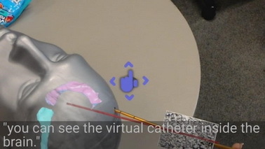 杜克大学使用HoloLens进行脑部手术 AR技术很实用