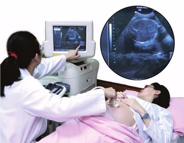 人能听到声音的频率范围是什么?超声波和次声