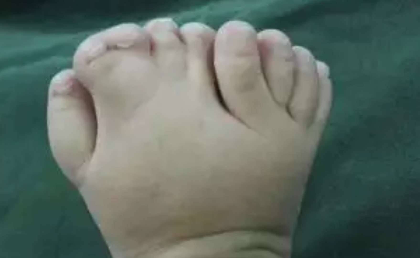 吃这个致宝宝耳朵脚畸形,婆婆后悔不已,这食物