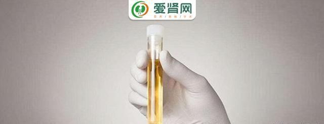 尿中有蛋白…莫慌!治疗秘诀最好记下来