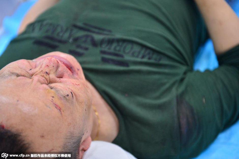 天津爆炸致400多人受伤 救援进行中