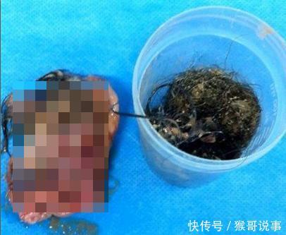 女子感觉肚子不对劲，去医院检查后，女子抱头流泪并痛骂前男友!