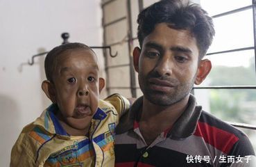 男孩一出生面容就像80岁老翁,医生表示没办法