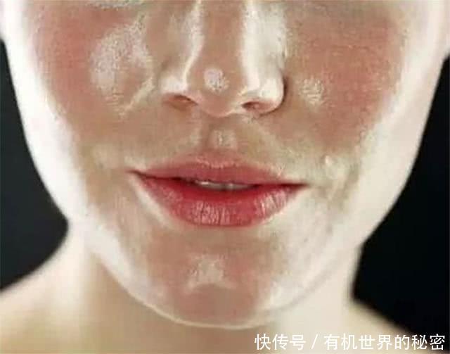 5道螨虫题,能答对2道,足以说明脸上螨虫过亿,不