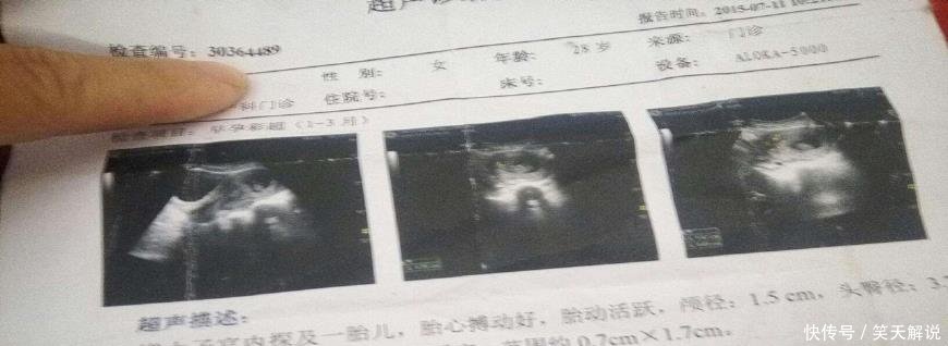 原来B超单上这2个数据,透露了胎儿这么多信息