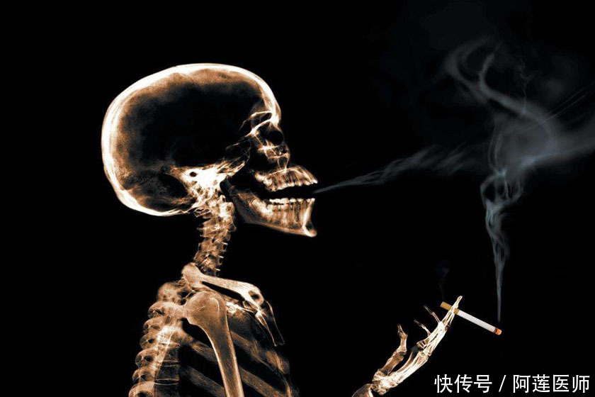 吸烟就是吸毒,你还认为吸烟是一种享受吗?