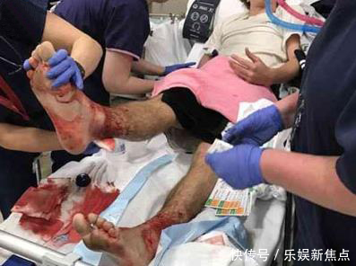 男子下海泡脚解乏,上岸后发现双脚上全是洞,原因让人惊讶不已