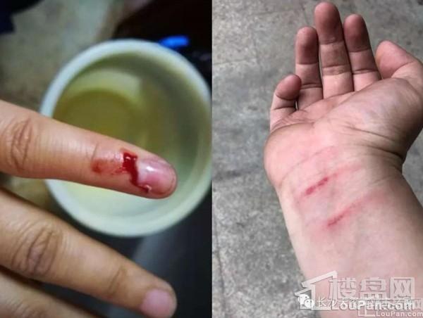 长沙碧桂园业委会筹备引发的红绿对垒!