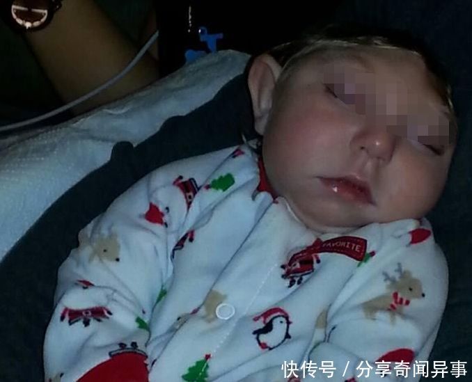 女孩只有半颗头,活到6岁去世,父母收拾她房间时,掀开床单懵了
