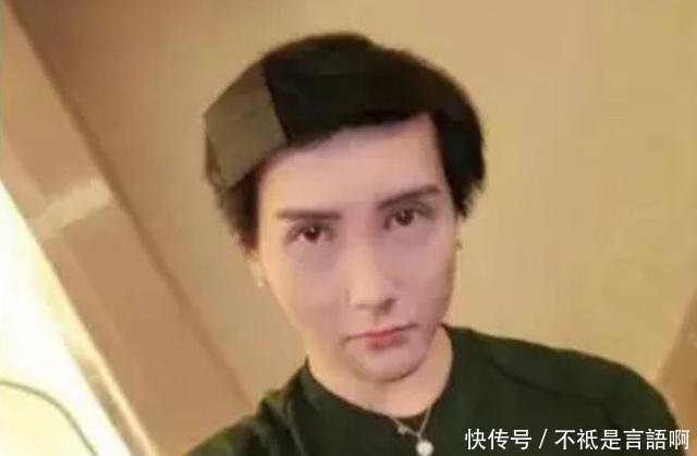 蛇精男重回自然,承诺脸上的玻尿酸都融掉,网