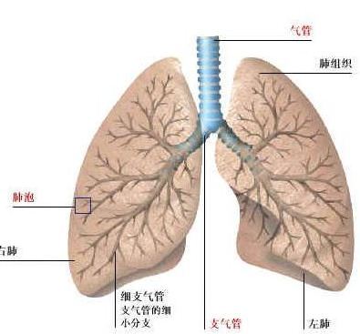 支气管扩张无症状