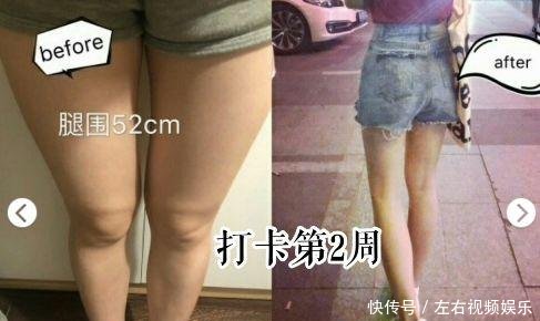 做什么运动瘦小腿最有效 t01c71dd1a30087200e.jpg