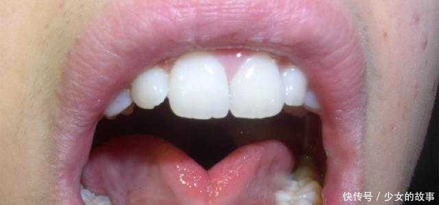 宝宝有这四种表现时,很可能是舌系带过短,妈妈