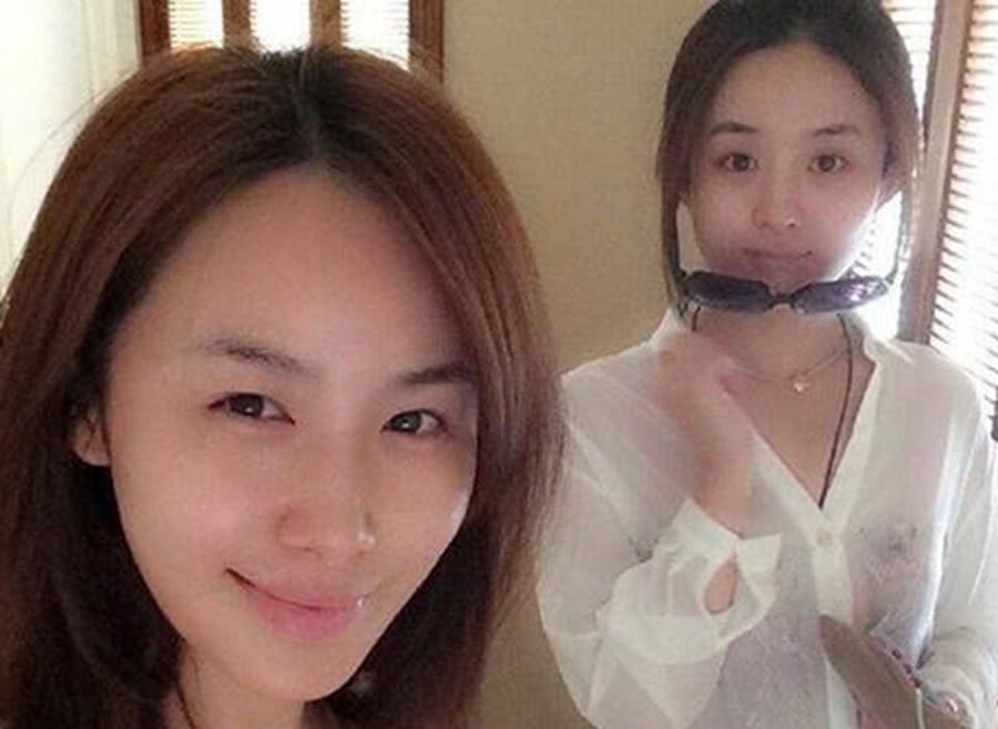 娱乐圈当红小花素颜大比拼,郑爽整容后颜值回