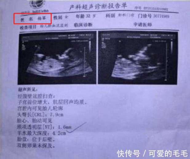 刘恺威8字回应二胎,杨幂要退出娱乐圈?网友:打