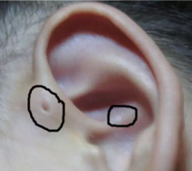 耳仓是怎么形成的_360问答