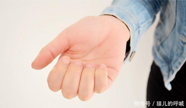 夏天手心发热?才不是正常现象,还可能是这6种