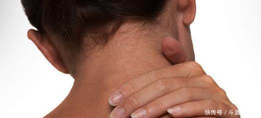 常受颈椎病折磨别怕,用这个中药处方辅助治疗