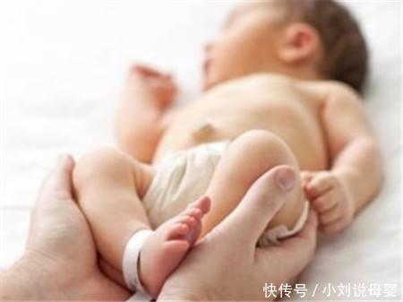 宝宝的腿看着像O型腿,该怎么办呢