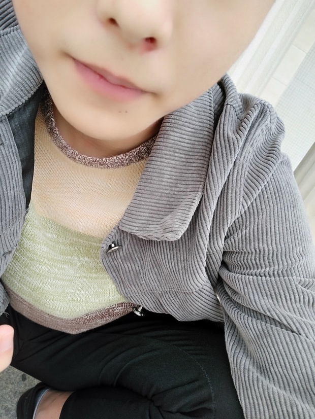 鼻侧最近红红的还有脓包,长了一个小头像,可高傲欧美血丝女生图片